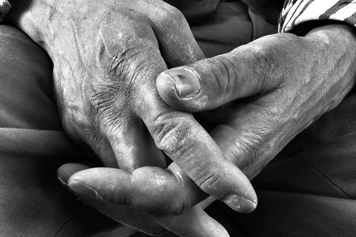 Kuvassa on vanhan miehen kädet sormet lomittain.
